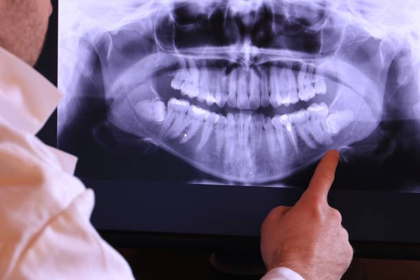 Best Mobile Emergency Dentist in East Dublin, GA