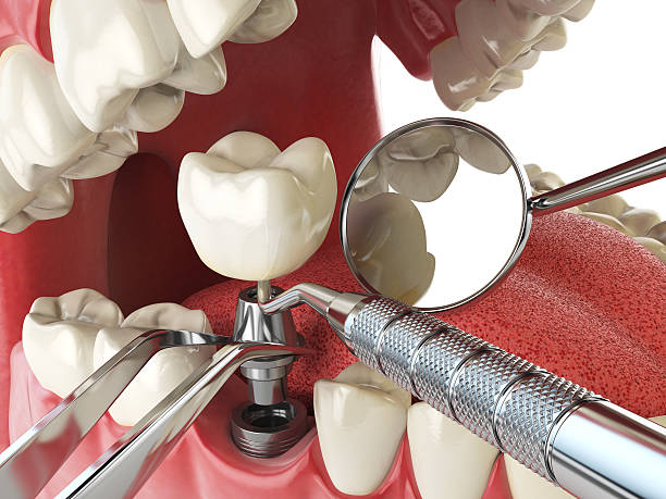 Best Pediatric Emergency Dentist in East Dublin, GA