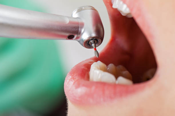Best Urgent Dental Care for Toothache in East Dublin, GA